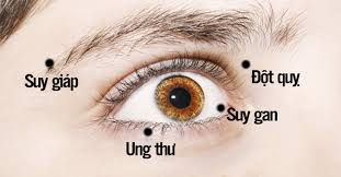 Chuyên gia cảnh báo 8 dấu hiệu của mắt