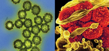 Sự khác biệt giữa Vi Khuẩn (Bacteria) và Siêu vi trùng (Viruses).