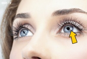Nhìn mắt đoán bệnh: Đôi mắt đang tiết lộ gì về sức khỏe của bạn?