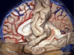 ảnh chụp não, động mạch, tim "động đậy" trong cơ thể người
